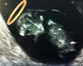 ultrasound card_jesus ultrasound card_jesus