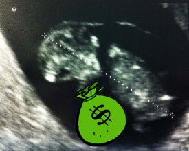 ultrasound card_money ultrasound card_money
