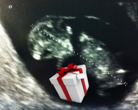 ultrasound card_present ultrasound card_present
